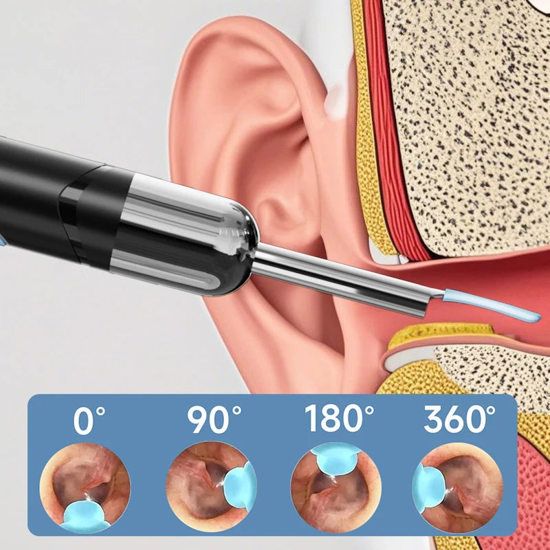 Smart Visual Ear Cleaner with HD Camera & Gentle LED Light