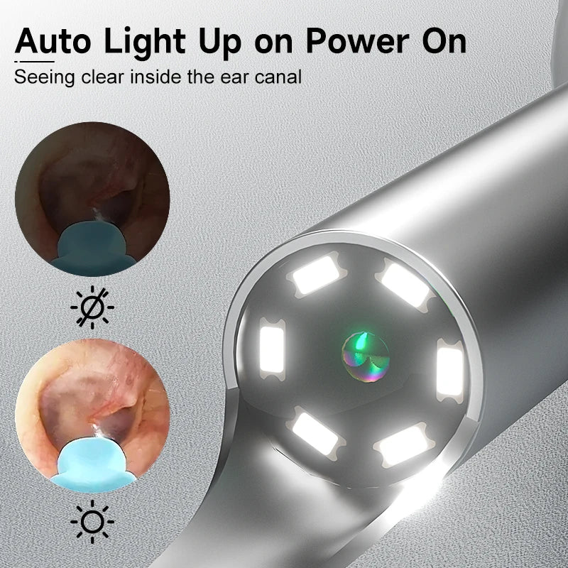 Smart Visual Ear Cleaner with HD Camera & Gentle LED Light